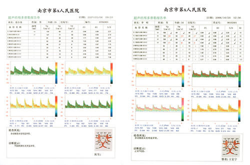 TCD检测报告